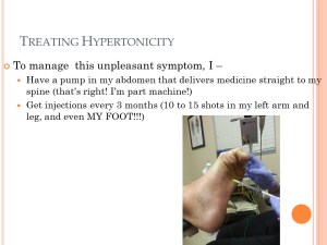 Treating Hypertonicity with Pic